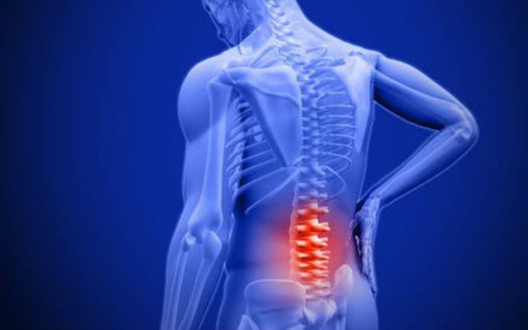 Nguyên nhân gây đau lưng mãn tính và cách giảm đau hiệu quả